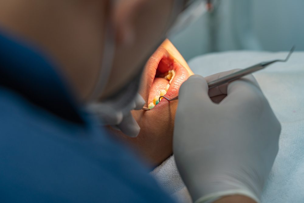Cracked tooth being examined by dentist in Leawood, KS